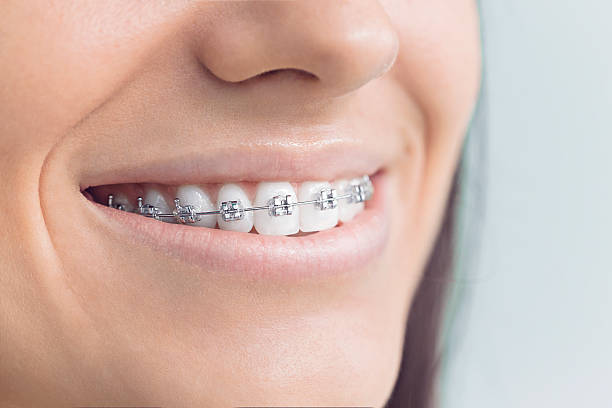 Best Invisalign and Clear Aligners  in Wichita Falls, TX